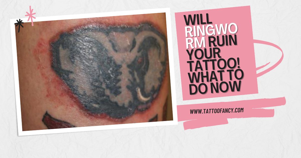 Will Ringworm Ruin Your Tattoo What To Do Now