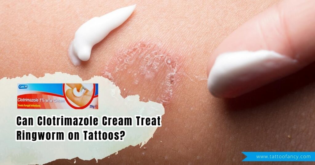 Can Clotrimazole Cream Treat Ringworm on Tattoos